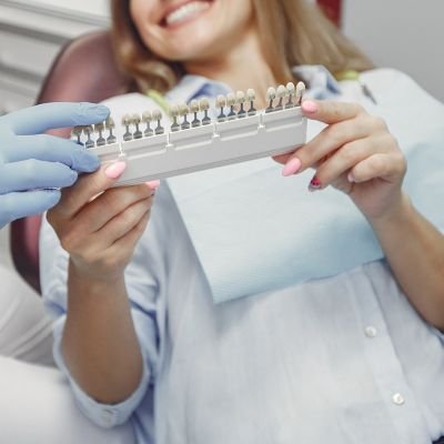 veneers