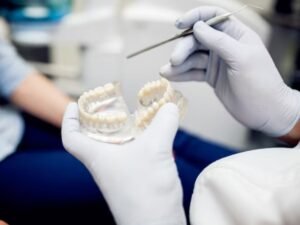 Dental Bridges