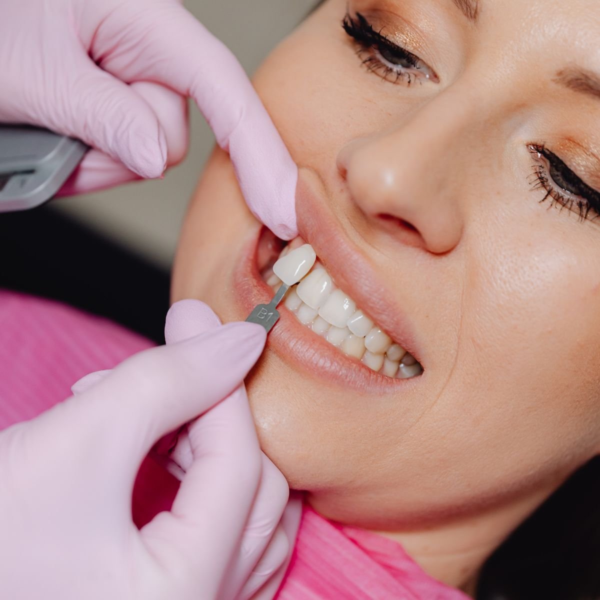 Dental Crowns in Park Ridge