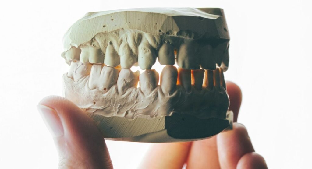 Dental Bridges